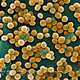 Muestra de Staphylococcus aureus. Foto: Wikipedia.